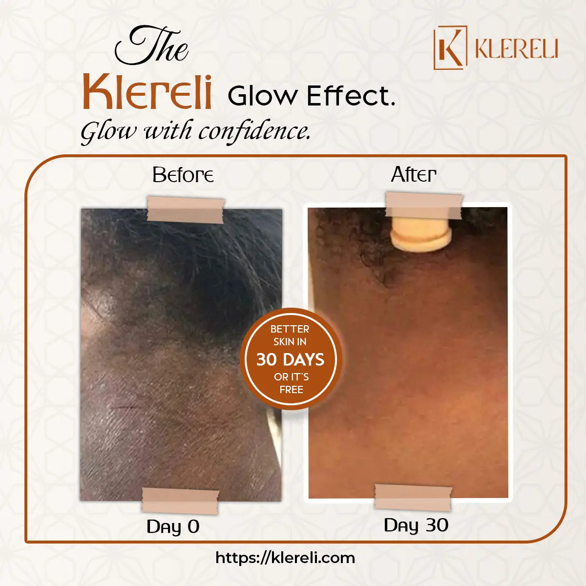 Kojic Acid & Turmeric Soap