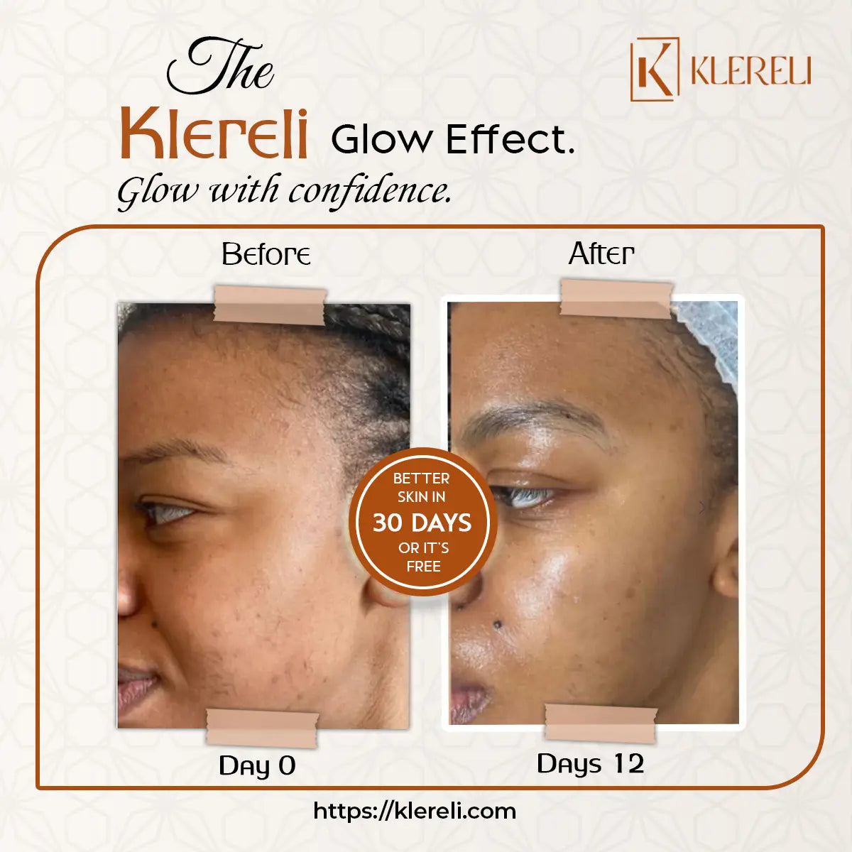 Kojic Acid & Turmeric Soap