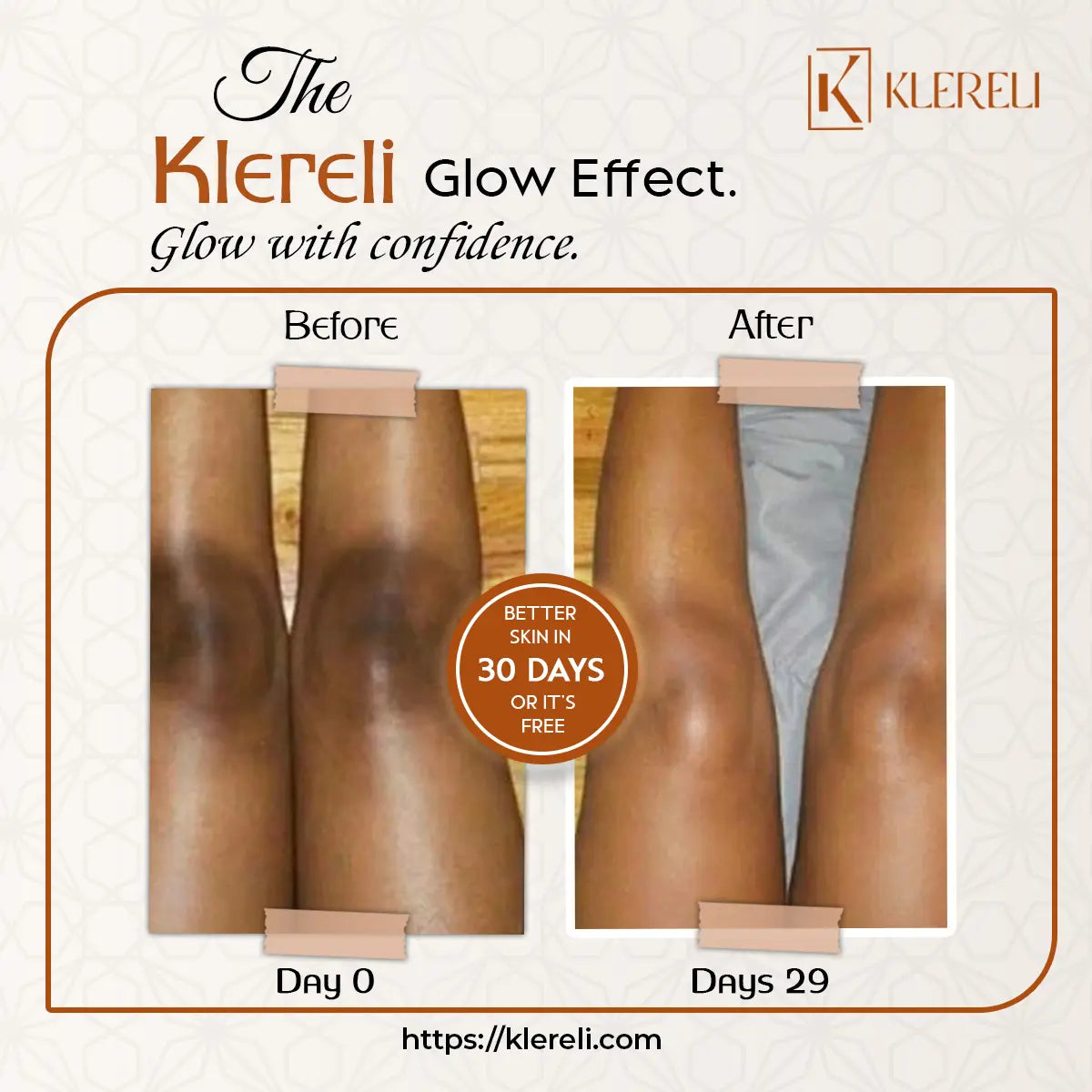 Kojic Acid & Turmeric Soap