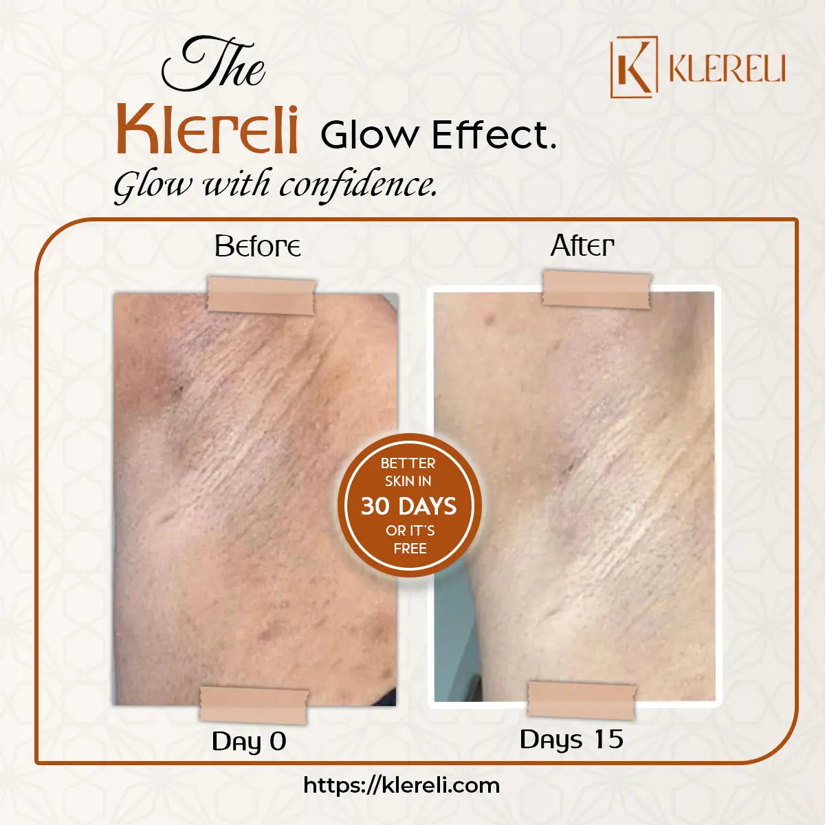 Kojic Acid & Turmeric Soap