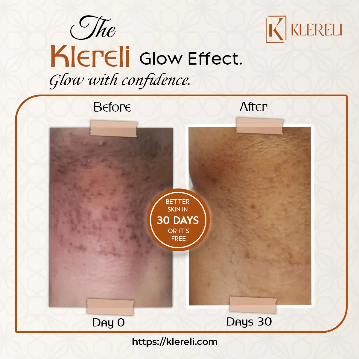 Kojic Acid & Turmeric Soap