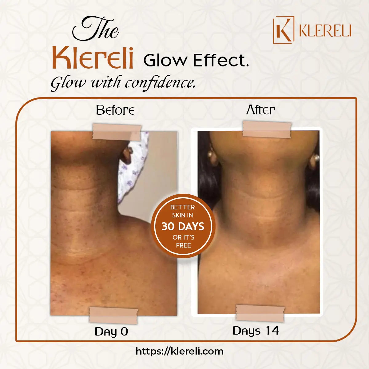 Kojic Acid & Turmeric Soap