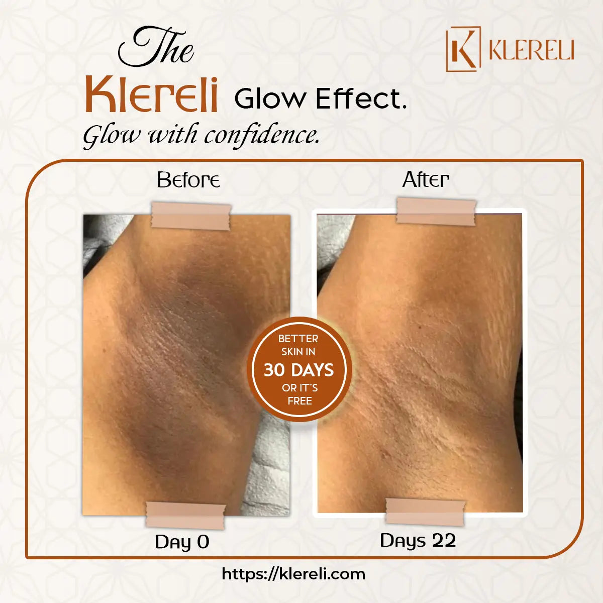 Kojic Acid & Turmeric Soap