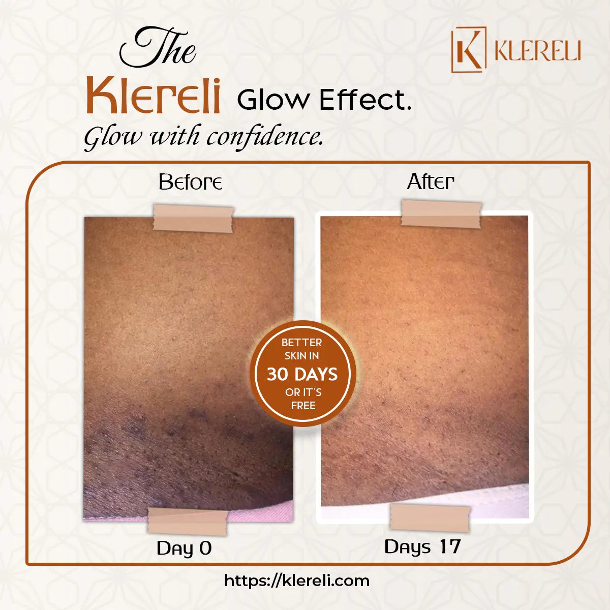 Kojic Acid & Turmeric Soap