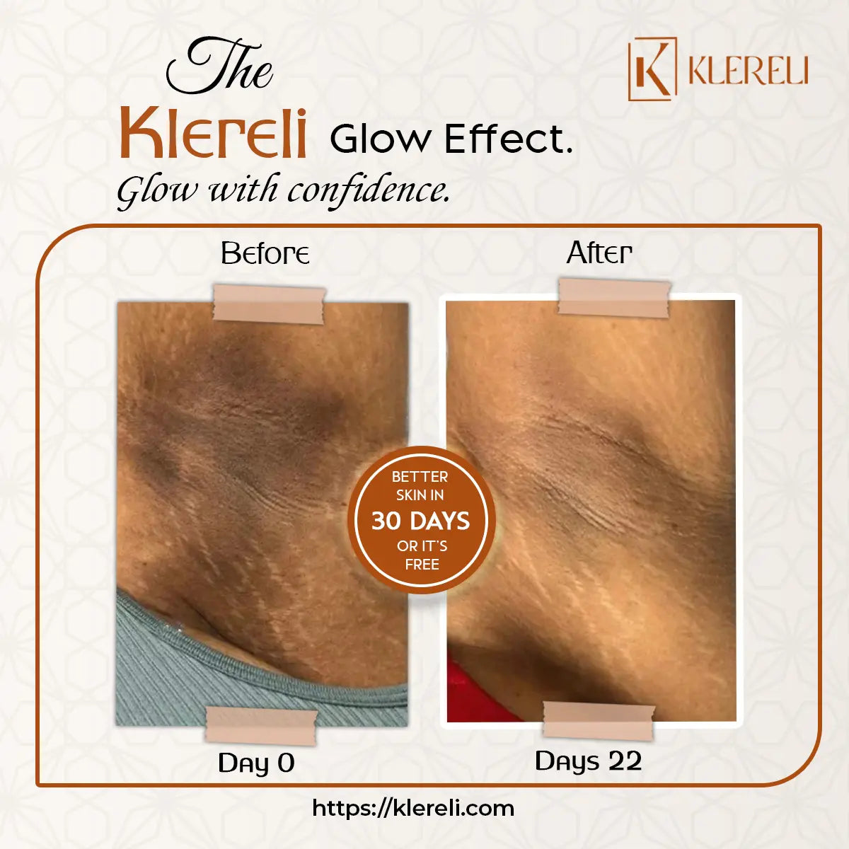 Kojic Acid & Turmeric Soap